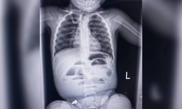 врятували дитину