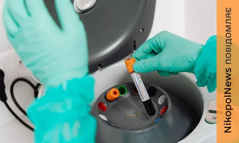 Рівень захворюваності ГРВІ знижується на Дніпропетровщині