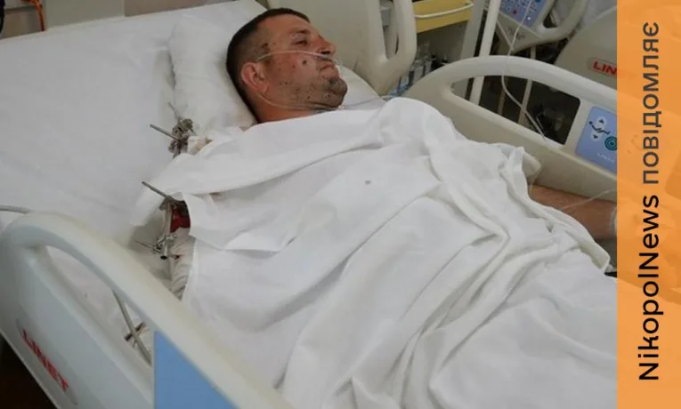 Житель Нікопольщини постраждав від удару ворожого дрона: деталі інциденту