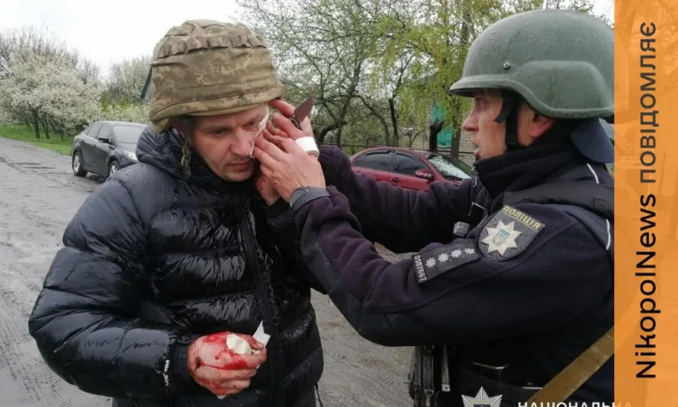 За останні три дні на Дніпропетровщині поранень зазнали 9 поліцейських