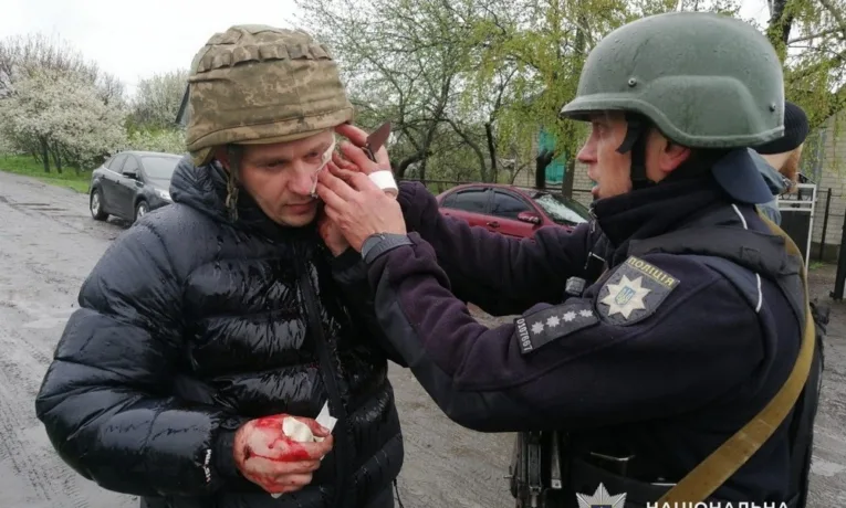 П'ятеро поліцейських поранено на Дніпропетровщині через вибух гранати під час затримання