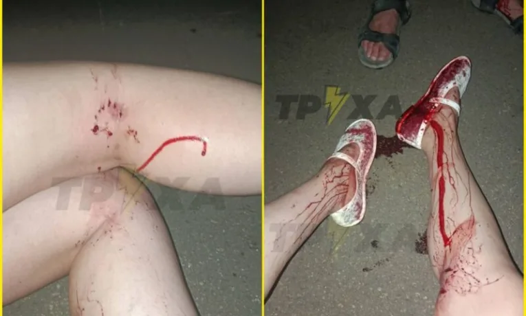 У Кривому Розі зграя собак напала на людей у парку